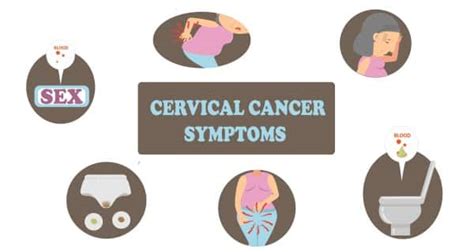 Identifying these 10 symptoms of cervical cancer on time ...