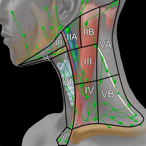 Illustration of the major neck lymph node levels, with ...