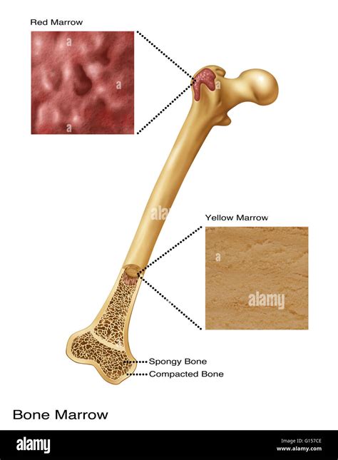 Ilustración de la médula ósea. El diagrama superior muestra la médula ...