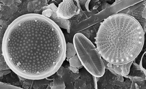 Imagen de microscopía electrónica de barrido donde se ven ...