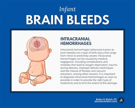 Infant Intracranial Hemorrhages  Brain Bleeds  | Birth ...
