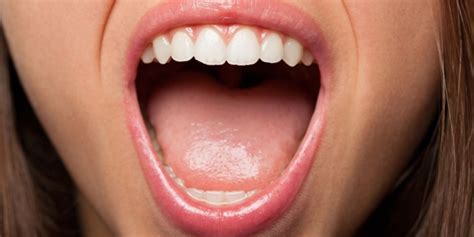 Infecciones en la lengua: ¿Cómo saber cuando tengo una? | DentiSalud ...