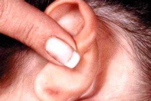 Inflamación de los ganglios linfáticos detrás de la oreja ...
