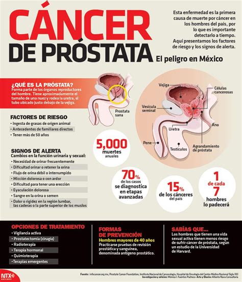 #Infografía Cáncer de próstata Leer nota | | Scoopnest