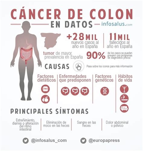 Infografía: Las claves del cáncer de colon