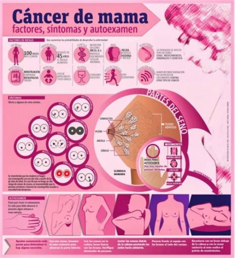 Infografía sobre el cáncer de seno: Síntomas y exámen