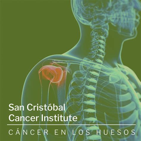 Información sobre Cáncer de Hueso | San Cristóbal Cancer ...
