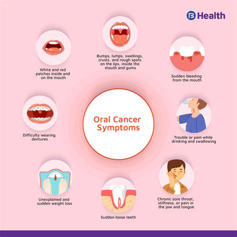 Informative guide to oral cancer symptoms, causes and ...