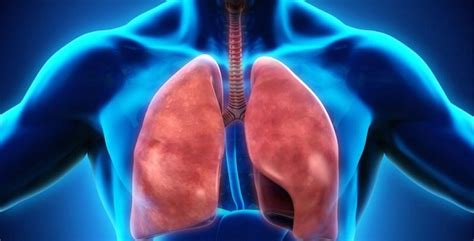 Inmunoterapia reduce riesgos en cáncer de pulmón con ...