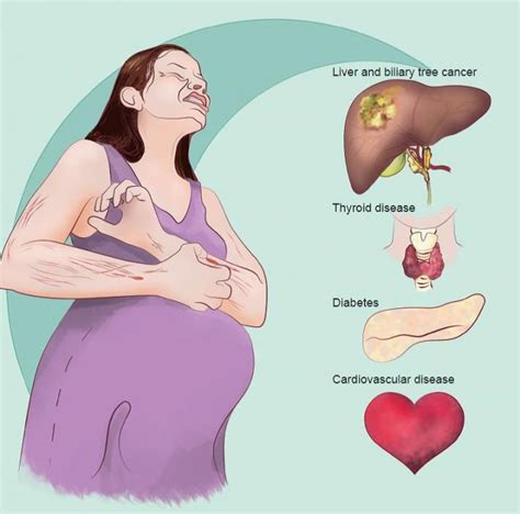 Intrahepatic cholestasis of pregnancy linked with liver ...