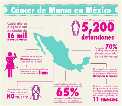 José Reyes Baeza – Infografía cancer de Mama en México