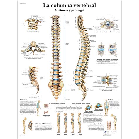 La columna vertebral   Anatomía y patología   4006820 ...
