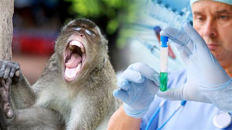 La EMA da su visto bueno a  Imvanex  como vacuna contra la viruela del mono