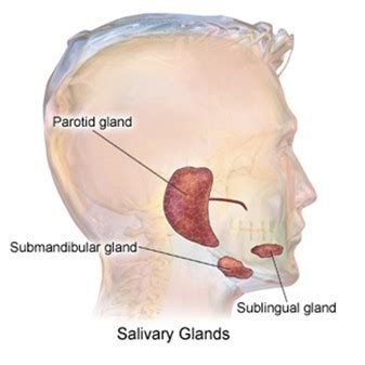 La glándula parótida: ¿Es muy común este tipo de cáncer?