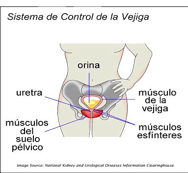La incontinencia urinaria en la mujer   Vistamedica
