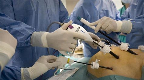 La laparoscopia mejora la cirugía del cáncer de recto