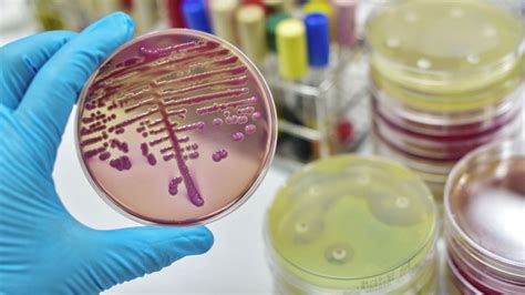 La OMS publicó una lista de bacterias resistentes a los antibióticos ...