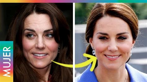 La polémica cirugía que se habría realizado Kate Middleton   YouTube