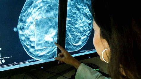 La tomosíntesis permite detectar un 40% más de tumores que la mamografía