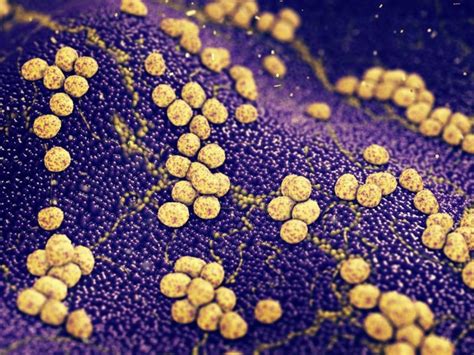 Las 10 Bacterias Patógenas Más Comunes para el Hombre