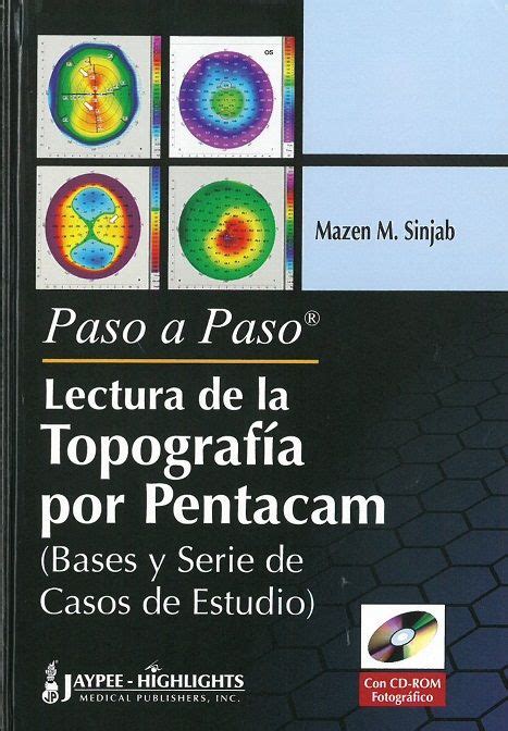 Lectura de la topografía por Pentacam :  bases y serie de ...