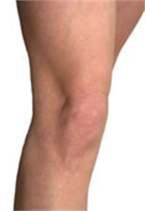 Lesiones de rodilla: El cartílago articular