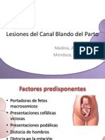 Lesiones Del Canal Blando Del Parto | Vagina | Parto