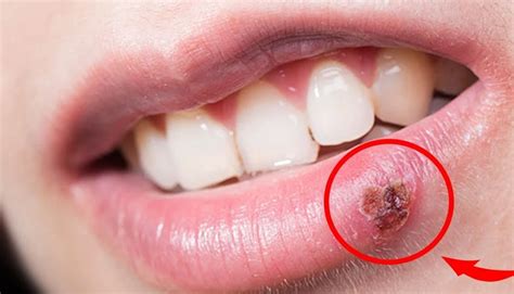 LESIONES PATOLÓGICAS – Odontología Especializada