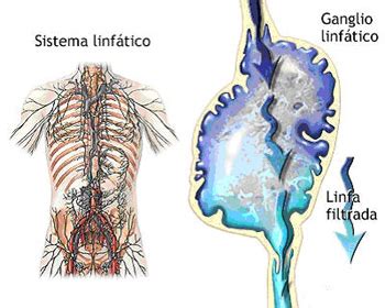 Linfoma   Información médica en Ferato, enciclopedia de la ...