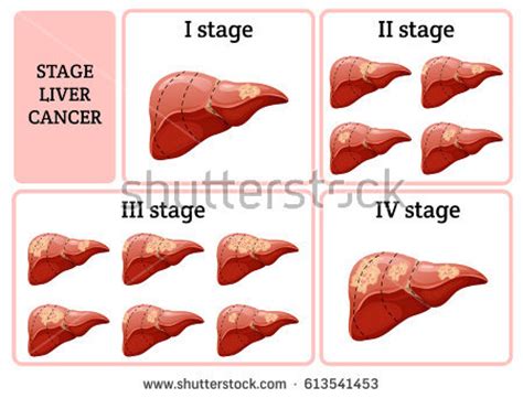 Liver Stock Images, Royalty Free Images & Vectors ...