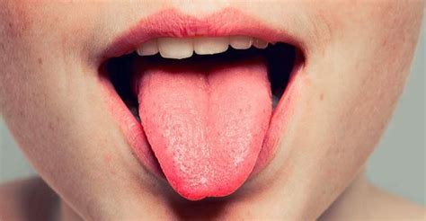 Llagas en la lengua: por qué aparecen y cómo curarlas