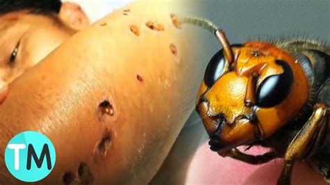 Los 10 Insectos Más Letales Del Mundo   YouTube