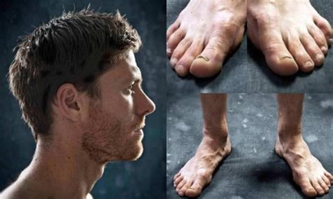 Los horribles pies de futbolistas famosos   Taringa!