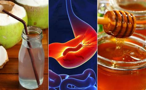 Los mejores remedios naturales para las úlceras y la gastritis – Hoy En ...