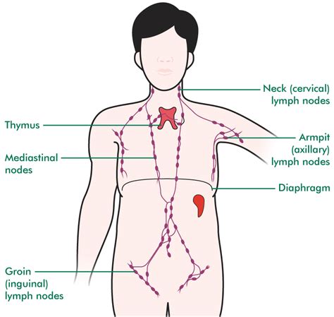 Lymphomas and the lymphatic system   Cancer information ...