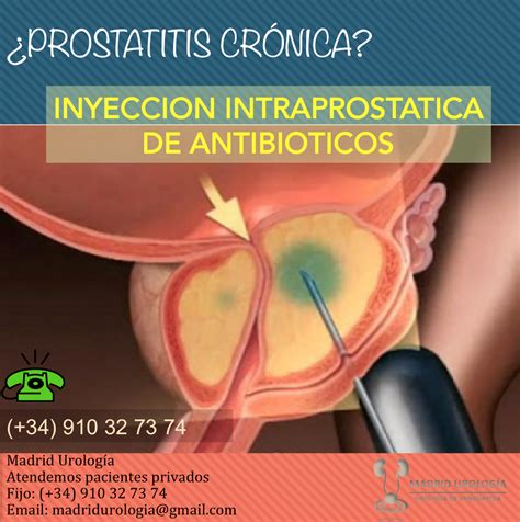 Madrid Urología: El Universo de la Prostatitis Crónica. MU