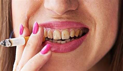 Mala higiene bucal causa más cáncer que fumar | Periodico La Pista