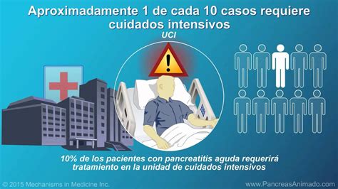 Manejo y tratamiento de la pancreatitis aguda   YouTube