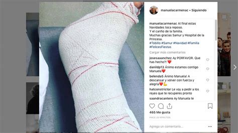 Manuela Carmena sufre una lesión en el tobillo y tiene que ...
