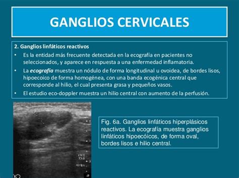 Masas Cervicales.Diagnostico Ultrasonografico