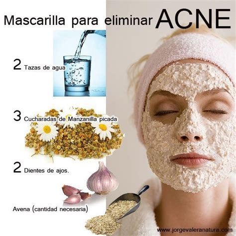 Mascarilla contra el acné #ConTuMarca | Eliminar acné ...