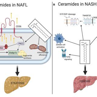 | Mechanisms of ceramides contribute to NALF and NASH ...