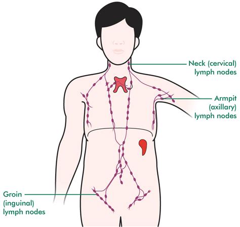 Mediastinal large B cell lymphoma   Understanding ...