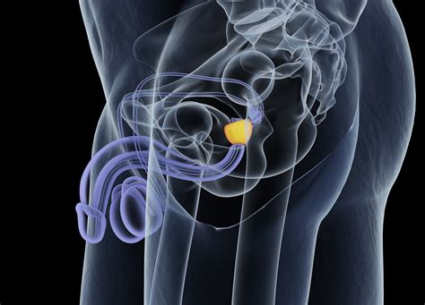 Men and Prostate Cancer: Fact Vs. Fiction | American Council on Science ...