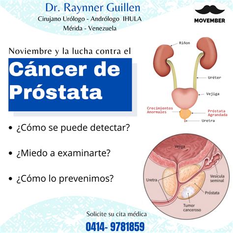Mes de concientización del cáncer de próstata | Famosa Store