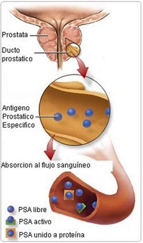 Metabolismo: Antígeno prostático. Equipo #6