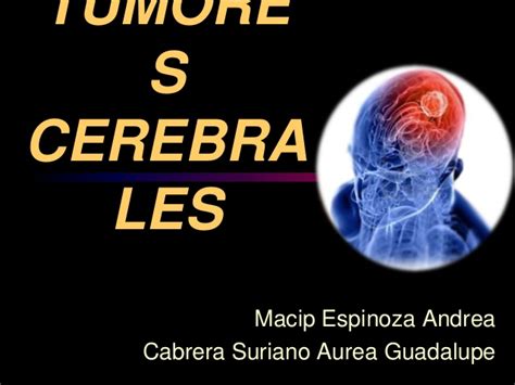 Metastasis Cerebral Sintomas Finales   SEONegativo.com