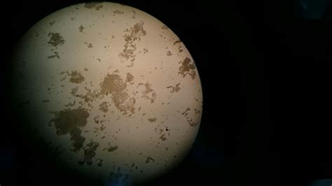 Microbiología: Moho de la naranja al microscopio