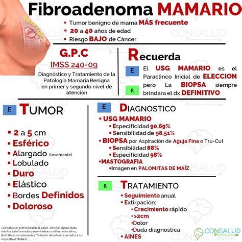 MIRtirizado  on Twitter:  Fibroadenoma MAMARIO  tumor benigno de ...