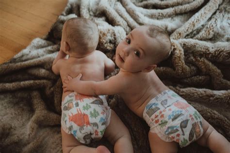 Mono mono twins, a rare and high risk pregnancy   Hamilton Health Sciences